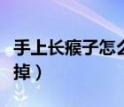 手上長瘊子怎么去掉圖片（手上長瘊子怎么去掉）