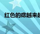 紅色的痣越來越多是怎么回事（紅色的痣）
