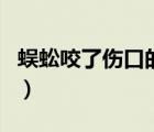 蜈蚣咬了傷口的形狀（蜈蚣咬了傷口的樣子圖）
