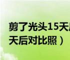 剪了光頭15天后對(duì)比照(第1頁)（剪了光頭15天后對(duì)比照）