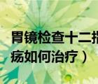 胃鏡檢查十二指腸潰瘍?nèi)绾沃委煟ㄊ改c潰瘍?nèi)绾沃委煟?/>
                                    </a>
                                                </div>
                                    <div   id=