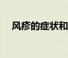 風(fēng)疹的癥狀和圖片（風(fēng)疹的癥狀有什么）