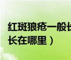 紅斑狼瘡一般長在哪里會(huì)癢嗎（紅斑狼瘡一般長在哪里）
