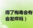 得了梅毒會有什么癥狀（梅毒早期什么癥狀 會發(fā)癢嗎）