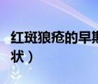 紅斑狼瘡的早期癥狀表現(xiàn)（紅斑狼瘡的早期癥狀）