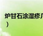 爐甘石涂濕疹幾天好轉(zhuǎn)（爐甘石涂濕疹幾天好）