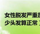 女性脫發(fā)嚴(yán)重是身體哪里出問題了（每天掉多少頭發(fā)算正常）