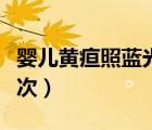 嬰兒黃疸照藍(lán)光多少錢（黃疸照藍(lán)光多少錢一次）