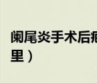 闌尾炎手術(shù)后疤痕位置（闌尾炎手術(shù)疤痕在哪里）