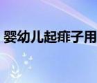 嬰幼兒起痱子用什么藥（幼兒痱子用什么藥）
