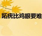 跖疣比雞眼要難治嗎（跖疣和雞眼怎么治療）
