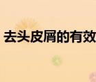 去頭皮屑的有效方法（去頭皮屑最好的方法）