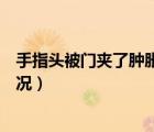 手指頭被門夾了腫脹疼痛怎么辦（手指頭腫脹疼痛是什么情況）