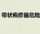 帶狀皰疹最危險的三個部位（帶狀皰疹癢嗎）