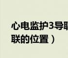 心電監(jiān)護(hù)3導(dǎo)聯(lián)位置圖片顏色（心電監(jiān)護(hù)3導(dǎo)聯(lián)的位置）