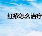 紅疹怎么治療最快方法（紅疹怎么治療）
