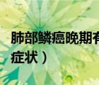 肺部鱗癌晚期有什么癥狀（肺鱗癌晚期有什么癥狀）