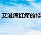 艾滋病紅疹的特點(diǎn)圖片（艾滋病紅疹的特點(diǎn)）