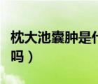 枕大池囊腫是什么意思（腦部枕大池囊腫嚴重嗎）