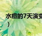 水痘的7天演變過(guò)程圖片（水痘破了怎么處理）