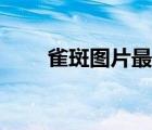 雀斑圖片最佳治療方法（雀斑圖片）