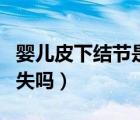 嬰兒皮下結(jié)節(jié)是什么原因（嬰兒皮下結(jié)節(jié)會消失嗎）