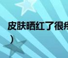 皮膚曬紅了很疼怎么辦（皮膚曬的紅痛怎么辦）