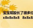 寶寶屁股長了很多紅點(diǎn)點(diǎn)怎么辦（8 8x8 8x8x8 8x8x8x8 8x8x8x8x8   8x8x8x8x8x8x8x8x8x8x8x8x）