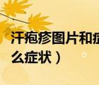 汗皰疹圖片和癥狀圖片手臂（汗皰疹圖片是什么癥狀）