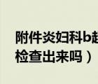 附件炎婦科b超能不能照出來（附件炎b超能檢查出來嗎）