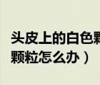 頭皮上的白色顆粒是什么（頭皮上有白色的小顆粒怎么辦）
