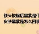 額頭拔罐后黑紫是什么原因（拔罐后皮膚黑紫的原因 拔罐后皮膚黑紫是怎么回事）