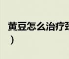 黃豆怎么治療頸椎?。S豆能夠治療頸椎病嗎）