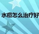 水痘怎么治療好得快初中生（水痘怎么治療）