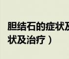 膽結石的癥狀及治療方法有哪些（膽結石的癥狀及治療）