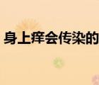 身上癢會傳染的是什么?。范旧砩蠒W嗎）