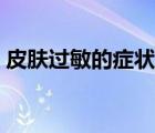 皮膚過敏的癥狀有哪些（螨蟲皮膚過敏癥狀）