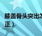 膝蓋骨頭突出怎么治療（膝蓋骨頭突出怎么矯正）