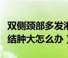 雙側(cè)頸部多發(fā)淋巴結(jié)腫大（雙側(cè)頸部多發(fā)淋巴結(jié)腫大怎么辦）
