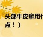 頭部牛皮癬用什么藥膏（頭部牛皮癬的癥狀特點?。?/>
                                    </a>
                                                </div>
                                    <div   id=