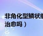 非角化型鱗狀細胞癌能治愈嗎（鱗狀細胞癌能治愈嗎）