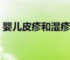 嬰兒皮疹和濕疹的區(qū)別（皮疹和濕疹的區(qū)別）