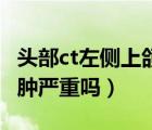 頭部ct左側(cè)上頜竇囊腫嚴(yán)重嗎（左側(cè)上頜竇囊腫嚴(yán)重嗎）