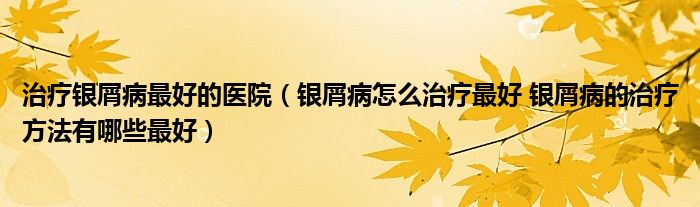 治療銀屑病最好的醫(yī)院（銀屑病怎么治療最好 銀屑病的治療方法有哪些最好）