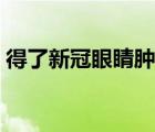 得了新冠眼睛腫痛怎么辦（眼睛腫痛怎么辦）