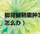 腳背腱鞘囊腫怎么辦才能消除（腳背腱鞘囊腫怎么辦）