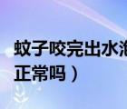 蚊子咬完出水泡是怎么回事（蚊子咬完起水泡正常嗎）