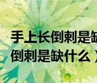 手上長(zhǎng)倒刺是缺什么維生素吃什么好（手上長(zhǎng)倒刺是缺什么）