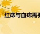紅痣與血痣需要治療嗎（血痣需要治療嗎）