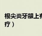 根尖炎牙齦上有個(gè)包怎么治療（根尖炎怎么治療）